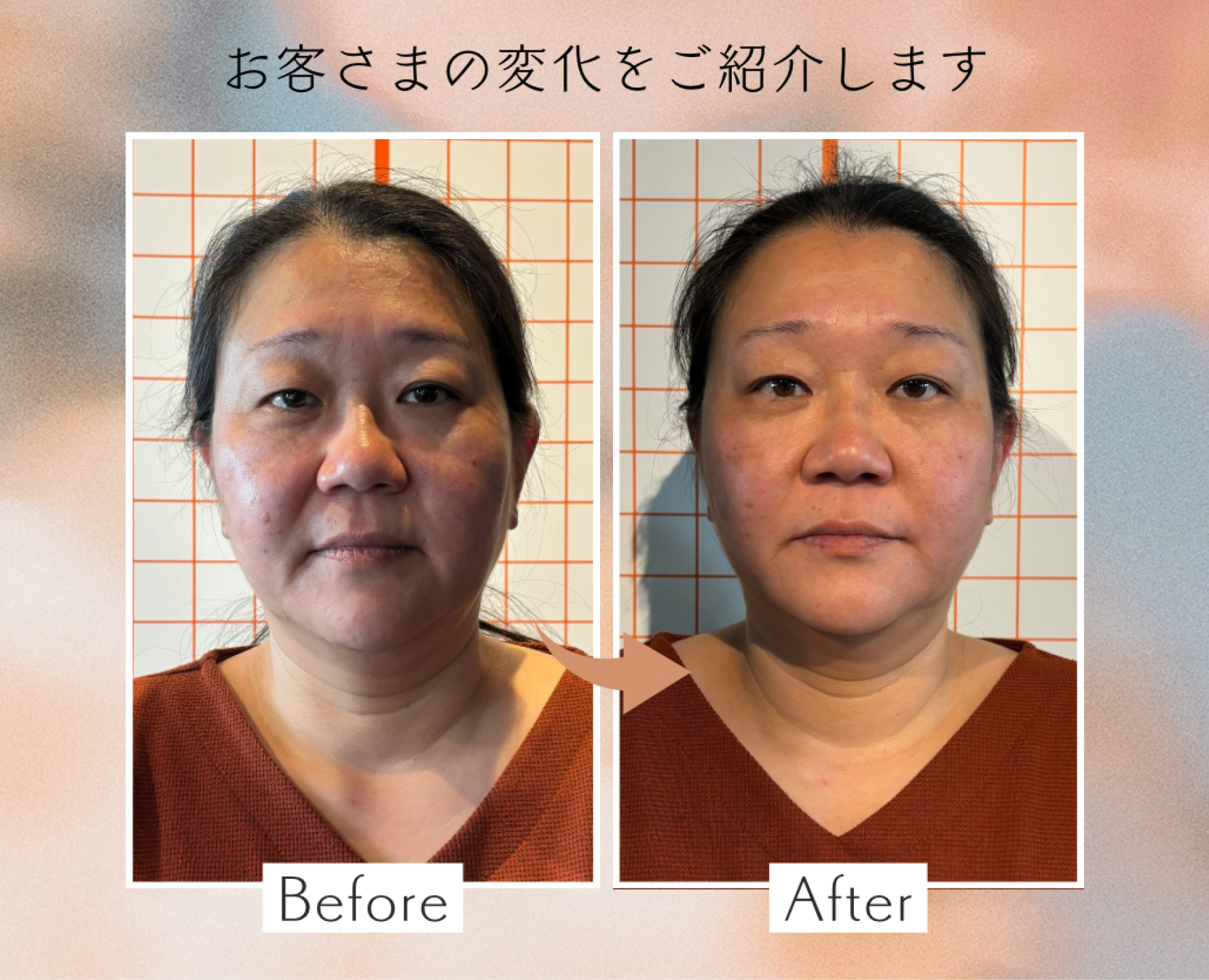 お客様の変化をご紹介します